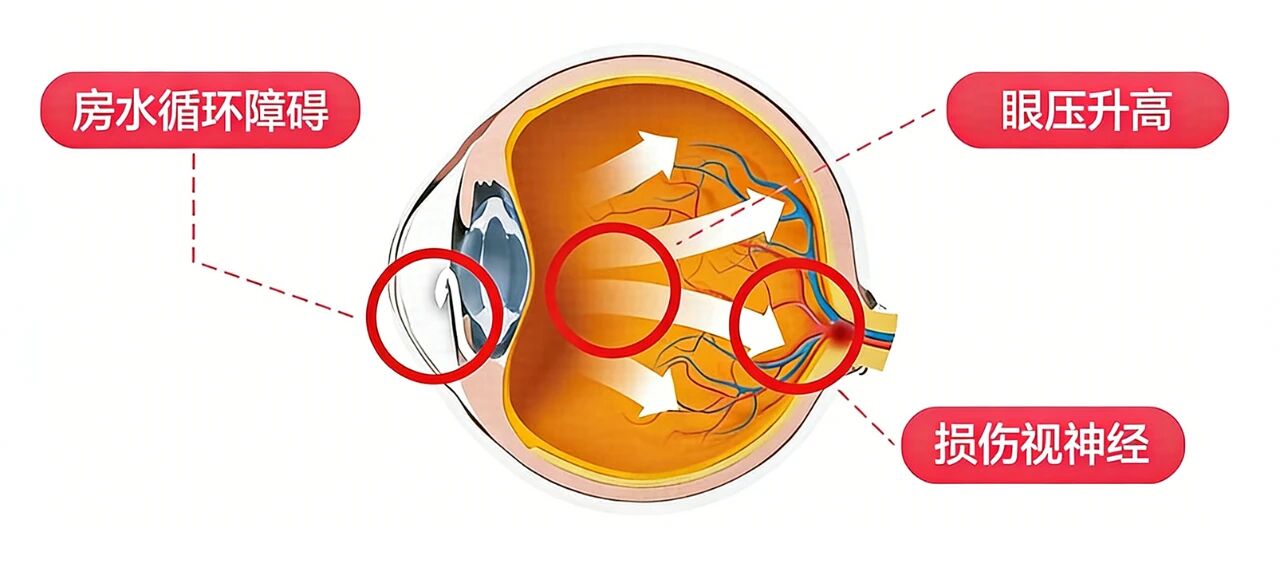 53bb54f334db392e1116a9b36657f53c.jpg 53bb54f334db392e1116a9b36657f53c.jpg